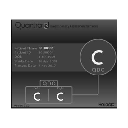 白い背景にホロジック Quantra 乳腺密度自動解析ソフトウェア